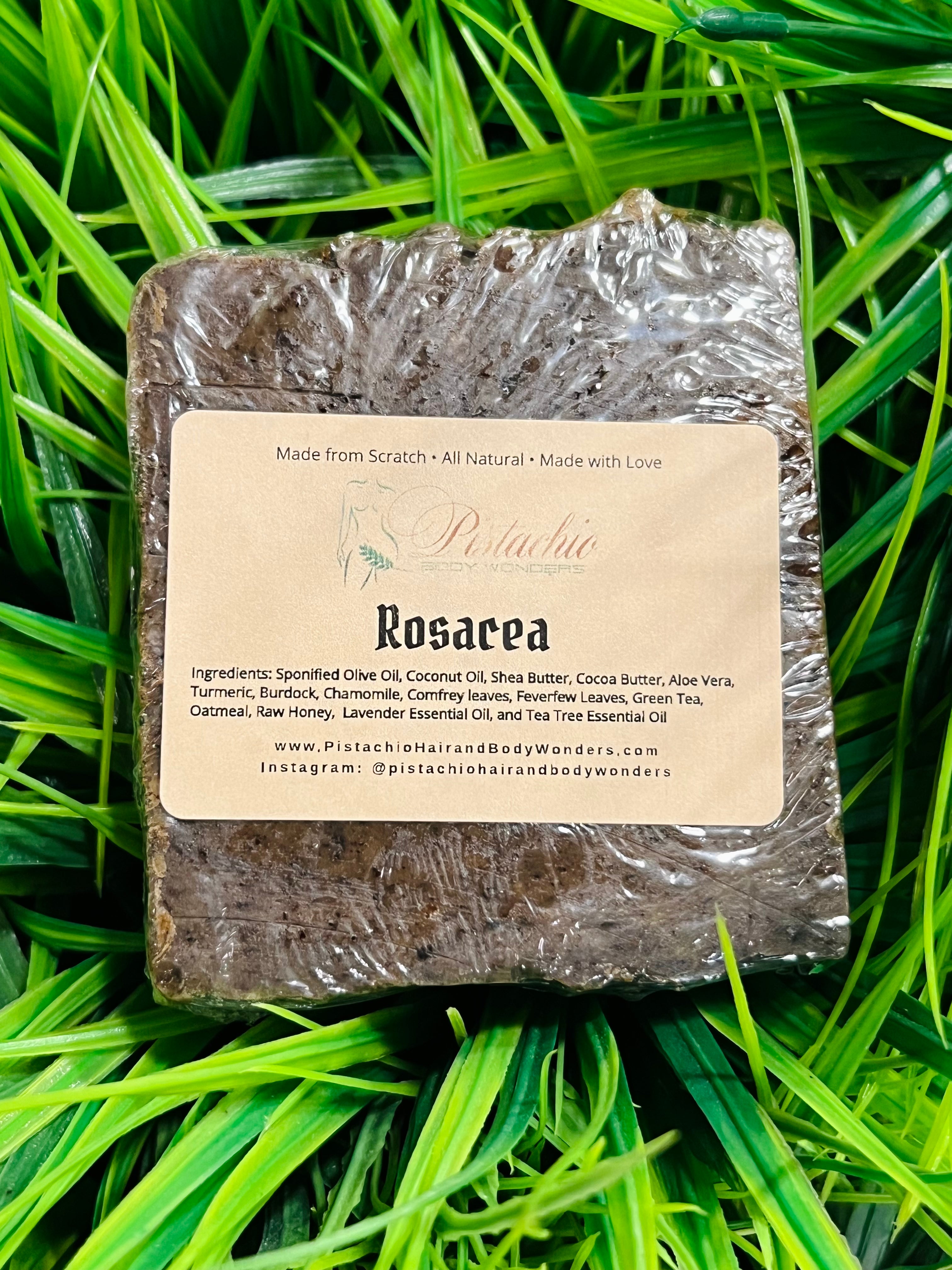 Rosacea Soap Bar (discontinuing)