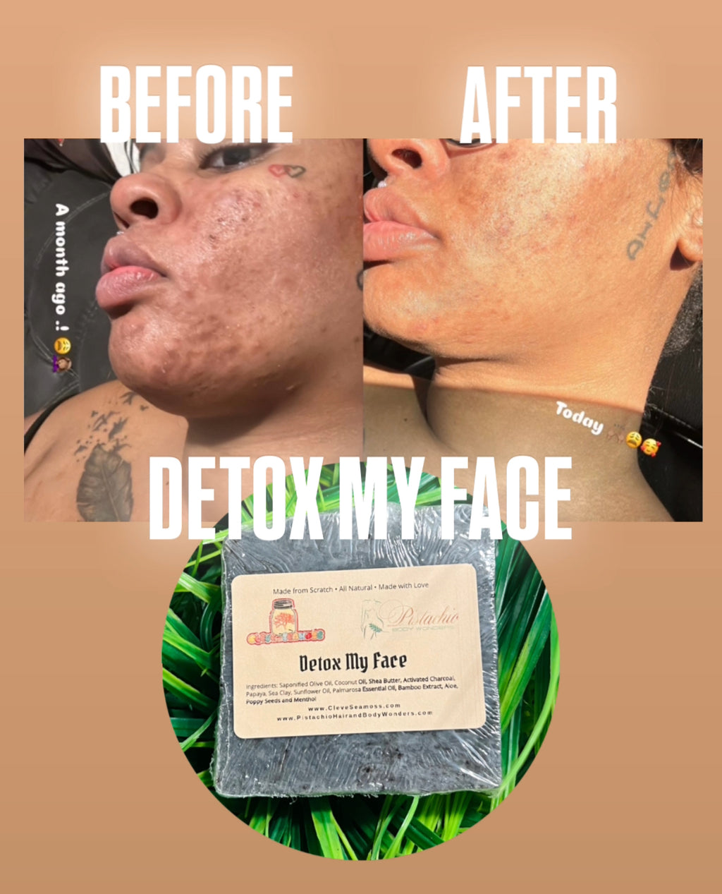 Detox My Face Soap Bar